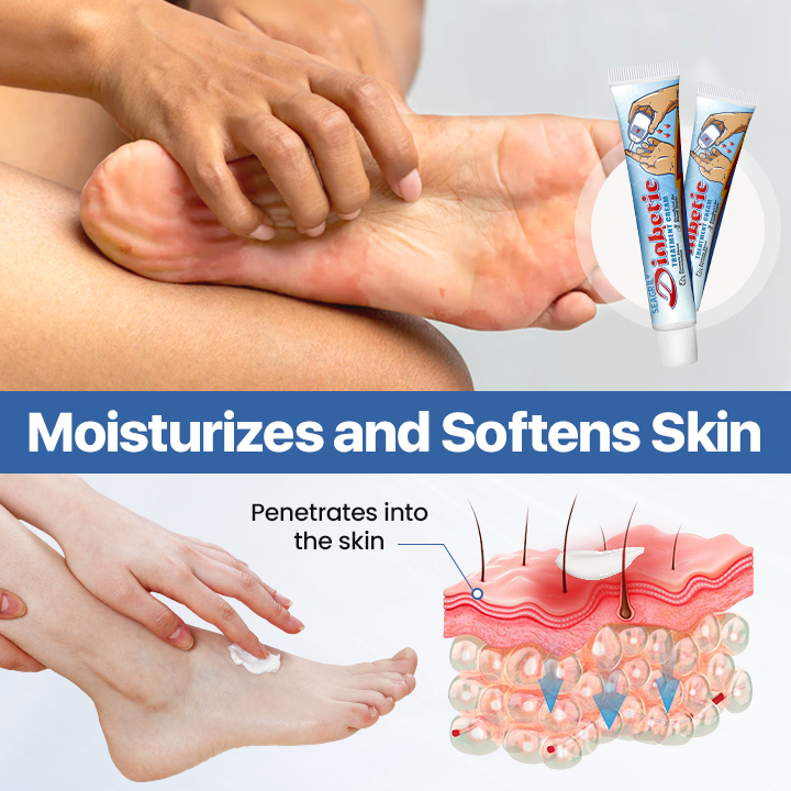SEAGRIL® VitaGluco Diabetes Treatment Cream✅ Heal Diabetic Wounds Faster & Safer