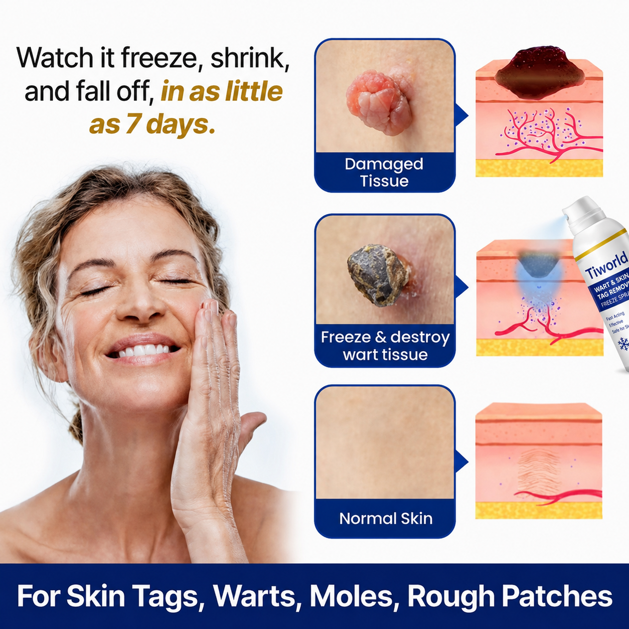 Tiworld® Bump Renewal Spray