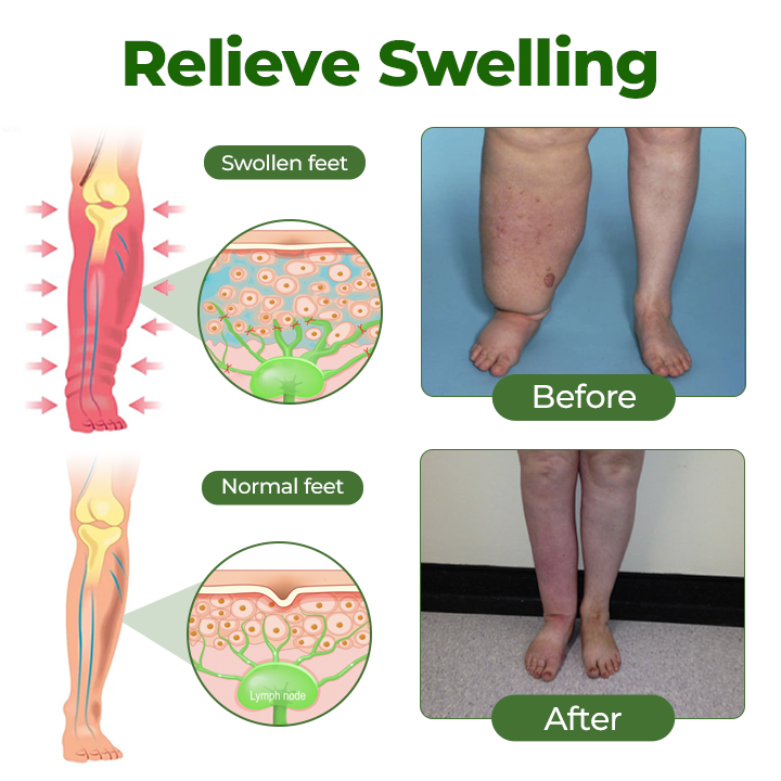 ✨SEAGRIL™ Professional Leg Circulation Cream Advanced Botanical Formula for Light Comfortable Legs🦵