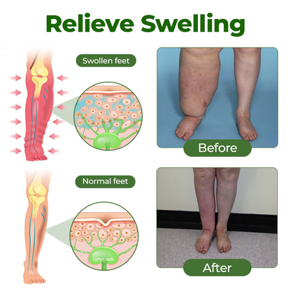 ✨SEAGRIL™ Professional Leg Circulation Cream Advanced Botanical Formula for Light Comfortable Legs🦵