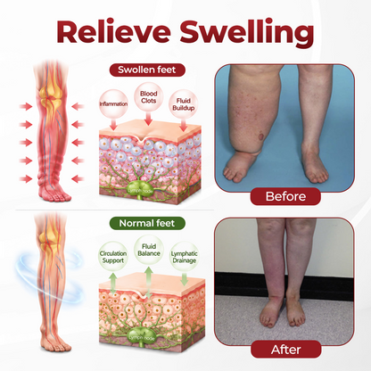 SEAGRIL® SwellVeil Leg Circulation Cream