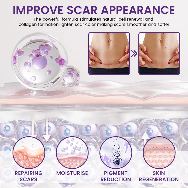 Seagril® ReGenScar Stem Cell Scar Gel-1