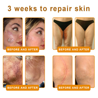 SEAGRIL®  𝐁𝐞𝐞 𝐏𝐨𝐢𝐬𝐨𝐧 𝐀𝐥𝐥-𝐢𝐧-𝐎𝐧𝐞 𝐂𝐫𝐞𝐚𝐦–🌸 Anti-aging,Hydrating, Skin Repair, Even Tone, Acne and Dark Spot Treatment, Wart and Mole Removal, Psoriasis Relief