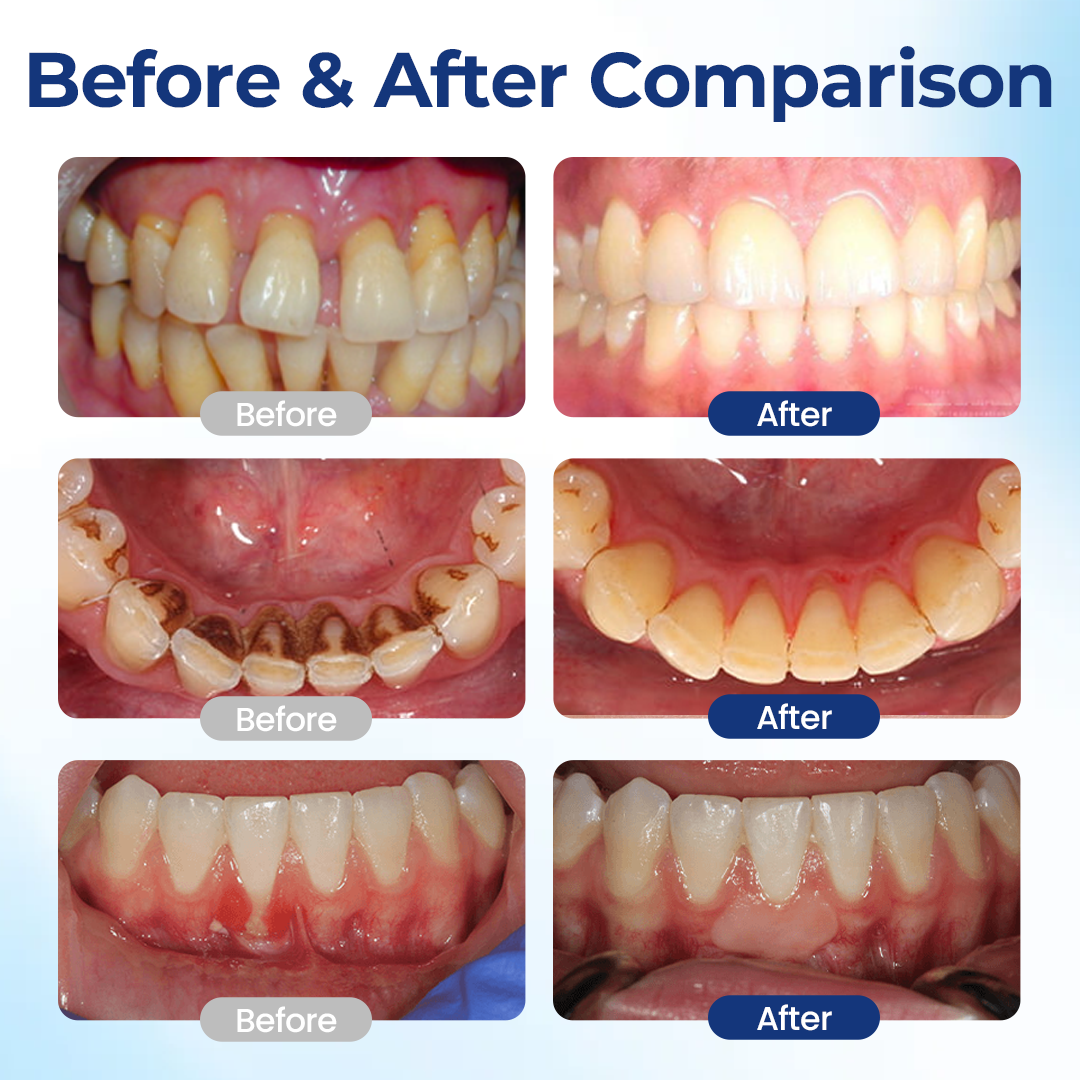 SEAGRIL® Repair Solution