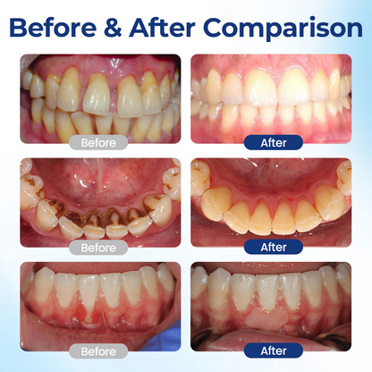 SEAGRIL® Repair Solution