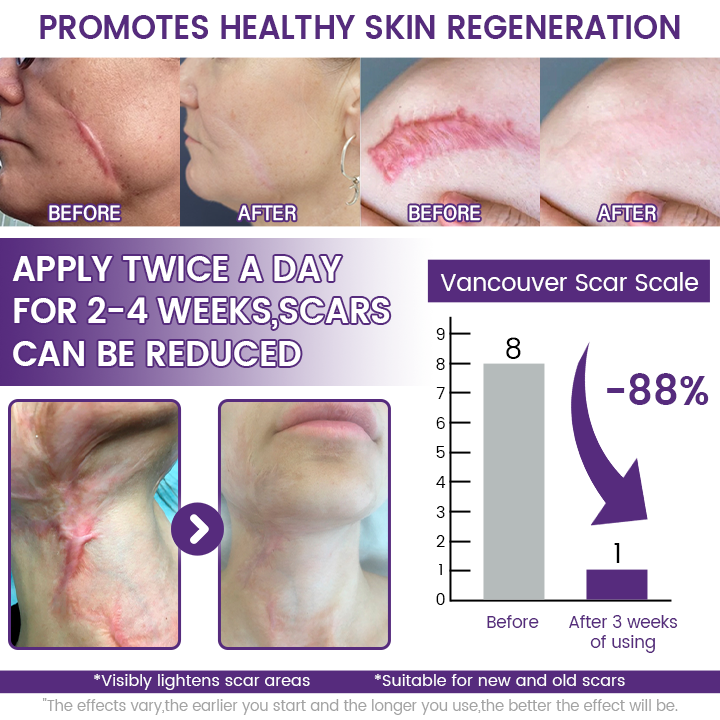 Seagril® ReGenScar Stem Cell Scar Gel-1