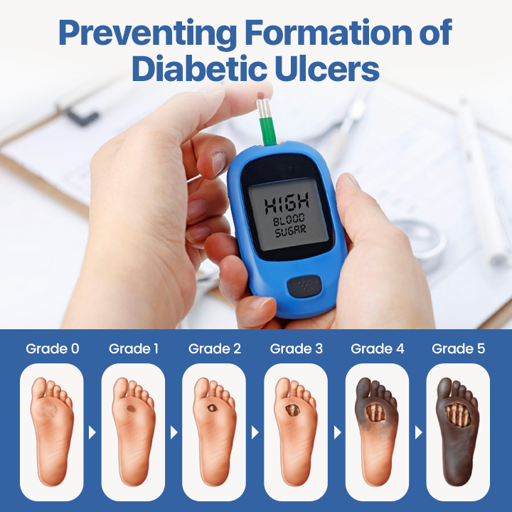 SEAGRIL® VitaGluco Diabetes Treatment Cream✅ Heal Diabetic Wounds Faster & Safer