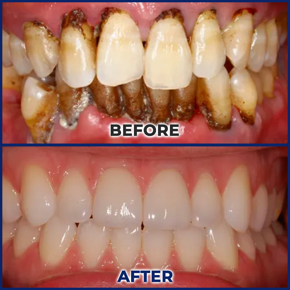SEAGRIL® Repair Solution
