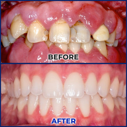 SEAGRIL® Repair Solution
