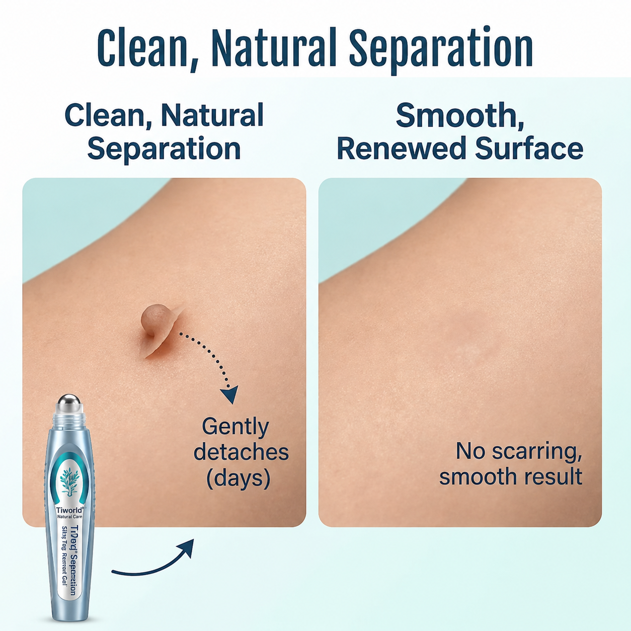💧Tiworld® SpotlessPro Advanced Skin Care Pen