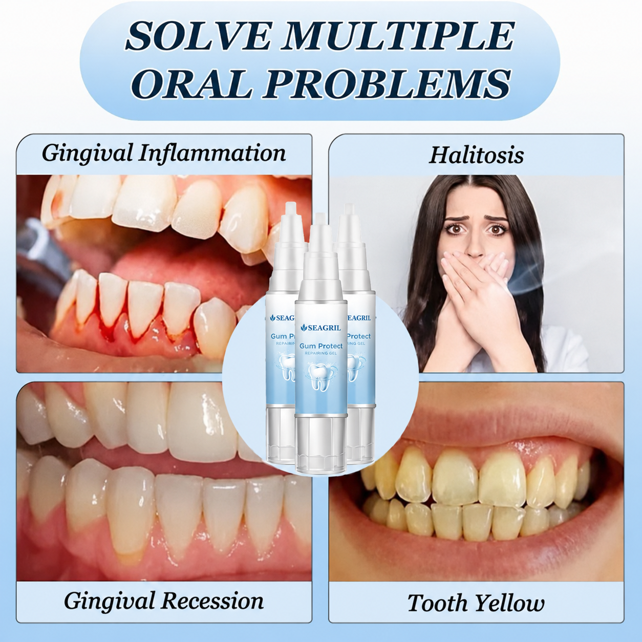 SEAGRIL — Stop Gum Recession and Bleeding Without Painful Surgery