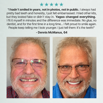 🌎Ends Today: 70% OFF! ⏰Yagoo™ Medical Full Denture with Strong Suctiond🦷Obtain American Dental Association (ADA) Certification