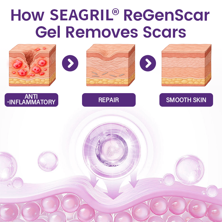 Seagril® ReGenScar Stem Cell Scar Gel-1