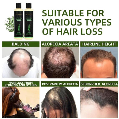 🌱SEAGRIL® Organic Rosemary Hair Growth Shampoo