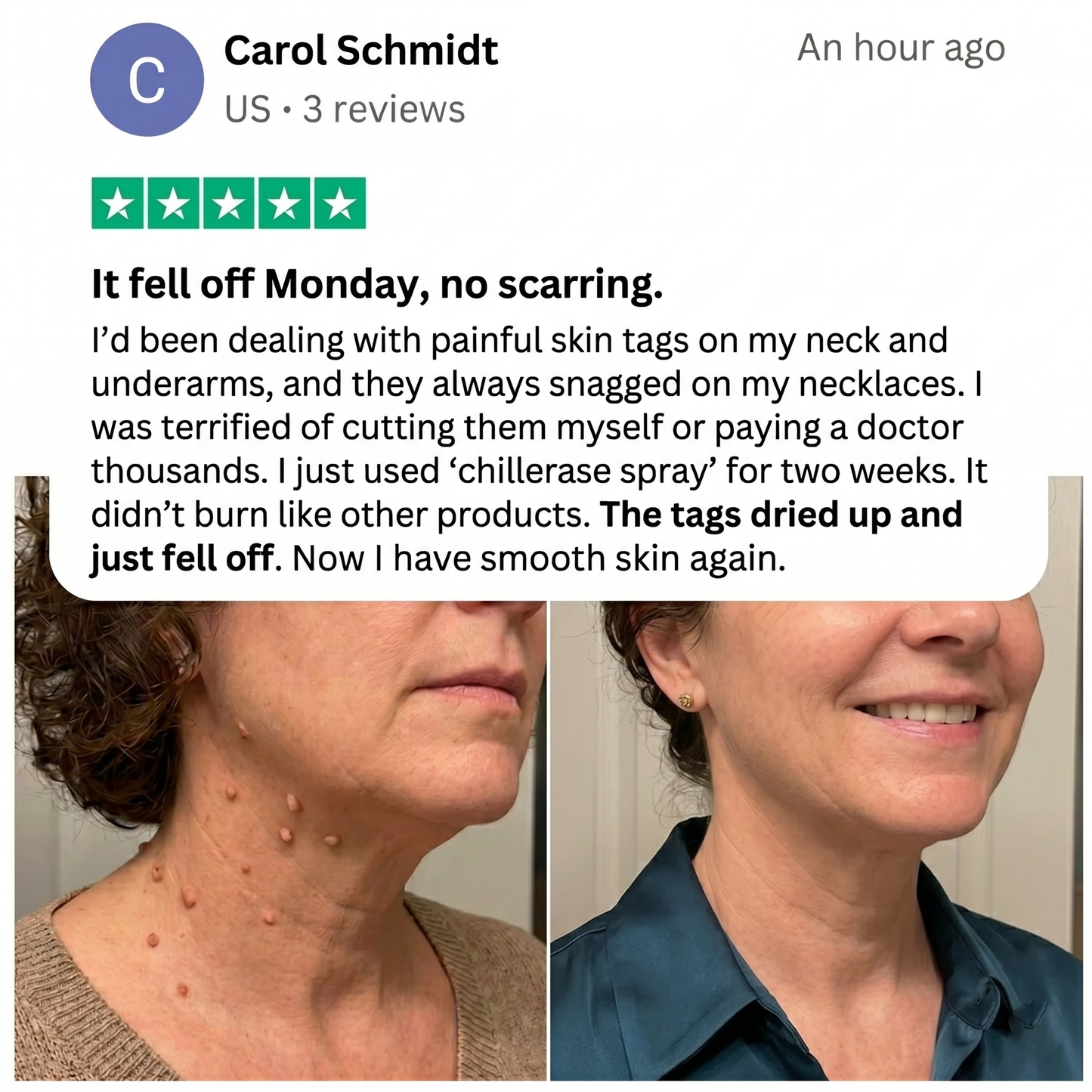 Tiworld® Bump Renewal Spray