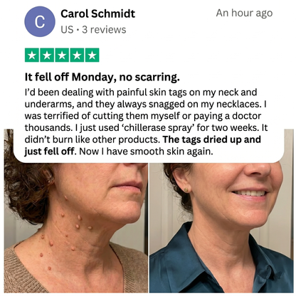 Tiworld® Bump Renewal Spray