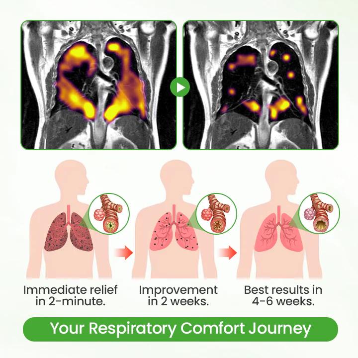❣️✅UK Owned and Operated|SEAGRIL® Botanical Mullein Lung Cleanse Diffuser (💝 Cough, wheezing, shortness of breath, sputum, stuffy nose, bronchitis, bronchitis, allergy symptoms, lung discomfort💝)