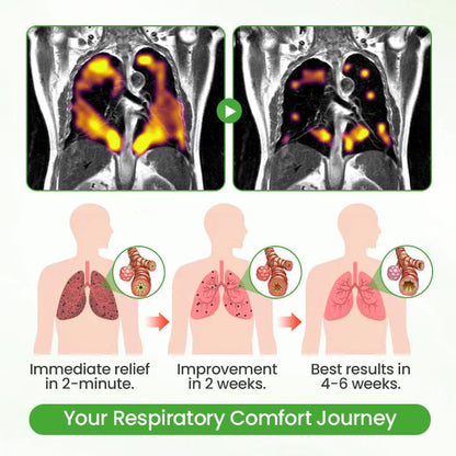 ❣️✅UK Owned and Operated|SEAGRIL® Botanical Mullein Lung Cleanse Diffuser (💝 Cough, wheezing, shortness of breath, sputum, stuffy nose, bronchitis, bronchitis, allergy symptoms, lung discomfort💝)
